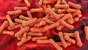 Diphtheria Cases 2026