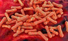 Diphtheria Cases 2026