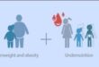Double Burden of Malnutrition