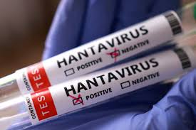 Hantavirus Alert